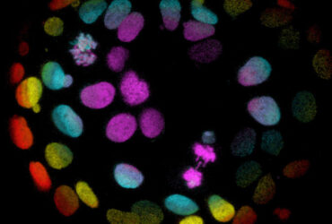 colorectal-organoid-article
